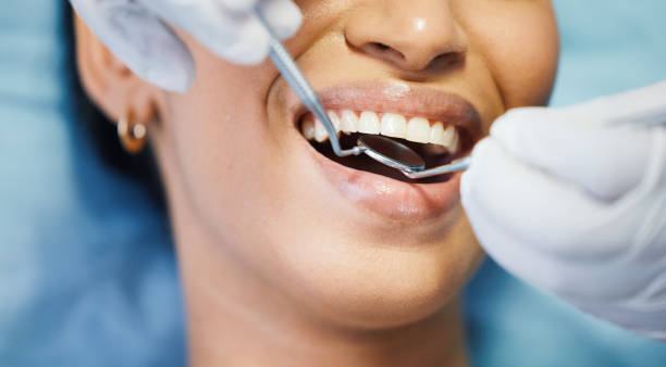 Emergency Gum Pain Relief in LA
